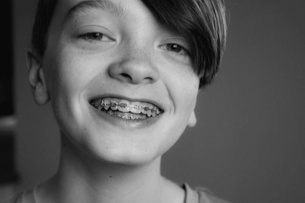 Aparelho Dental